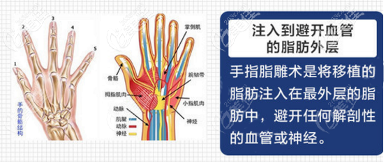 手背脂肪填充该去哪里做 手背脂肪填充该去哪里做