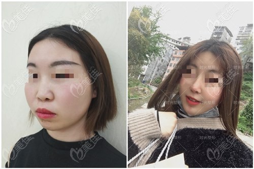 重庆时光整形医院案例