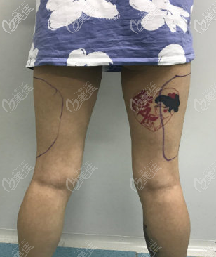 从后面看腿更粗