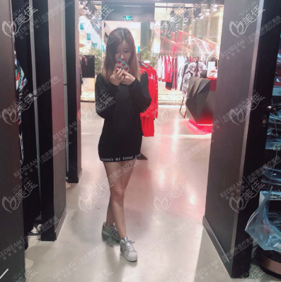 在北京做大腿环吸好的医院做完抽脂后,没有出现术后硬结等后遗症