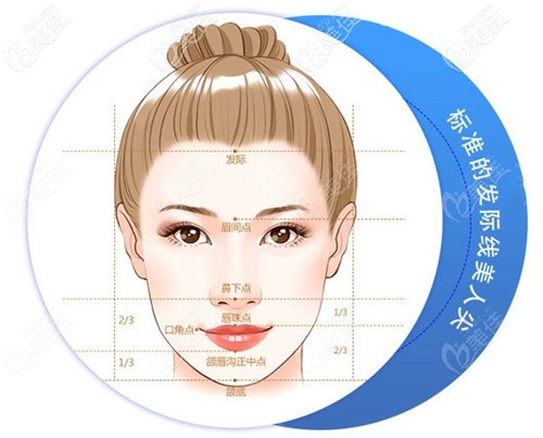 美人尖种植的价格 美人尖种植的价格
