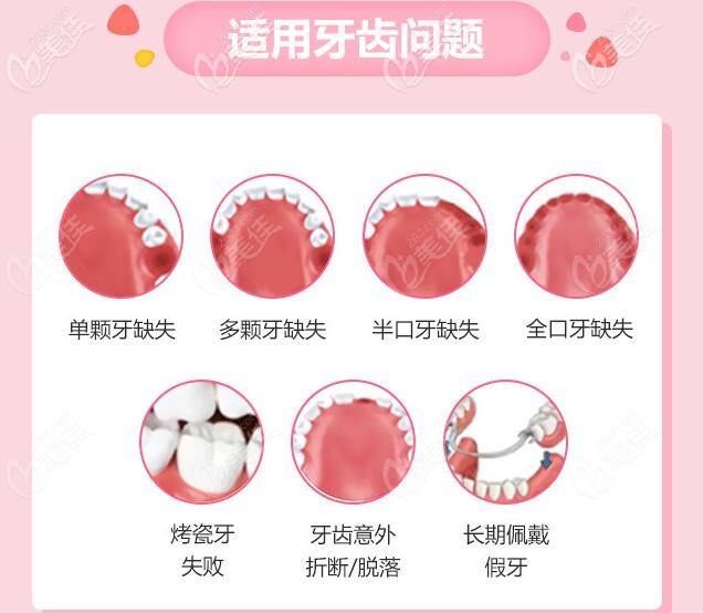 广州穗江口腔种植牙适应症