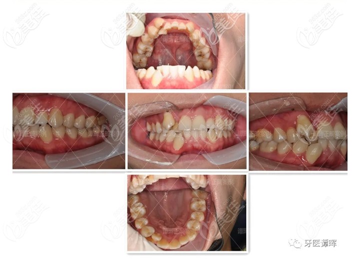 矫正前图片 矫正前图片