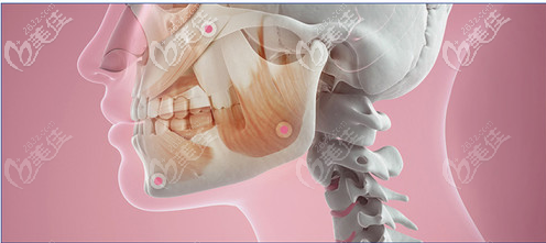 广州中家医家庭医生聂云飞下颌角改脸型优势 广州中家医家庭医生聂云飞下颌角改脸型优势