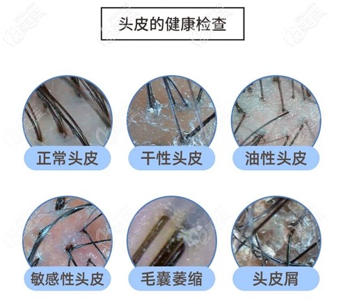 碧莲盛专业毛囊检测设备 碧莲盛专业毛囊检测设备