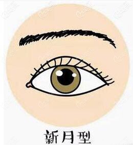 新月型双眼皮形态