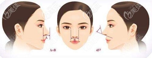 隆鼻手术的美学