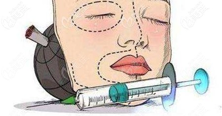 骨膜贴片隆鼻没有论证是否安全