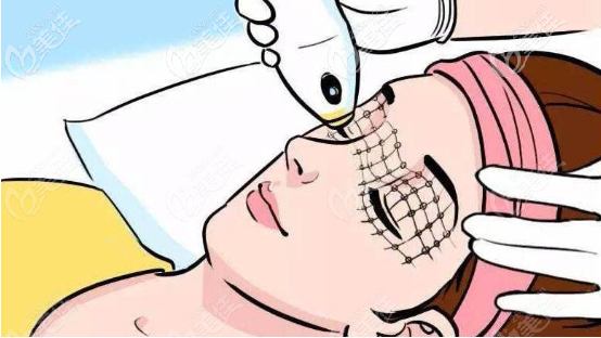 热玛吉治疗过程 热玛吉治疗过程