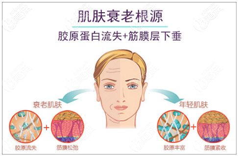 热玛吉治疗过程 热玛吉治疗过程