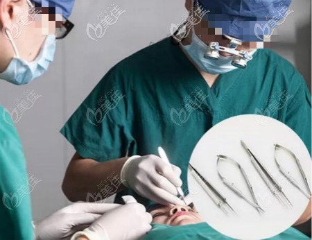 武汉涵美冯晓玲院长双眼皮手术过程中 武汉涵美冯晓玲院长双眼皮手术过程中