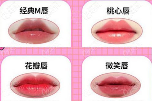 M唇桃心唇花瓣唇微笑唇区别
