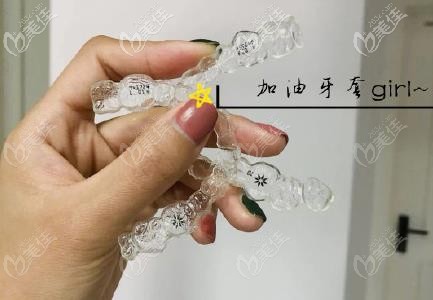 隐适美牙套 隐适美牙套