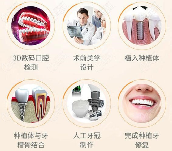 南宁牙百年口腔黄干医生做种植牙怎么样 南宁牙百年口腔黄干医生做种植牙怎么样