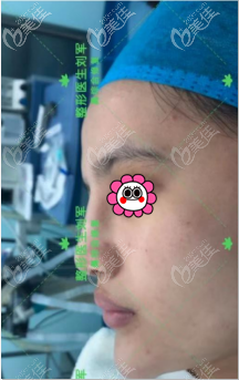 在北京美憬做鼻综合修复前 在北京美憬做鼻综合修复前
