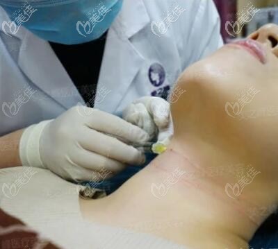 李健医生注射嗨体去颈纹手术过程中