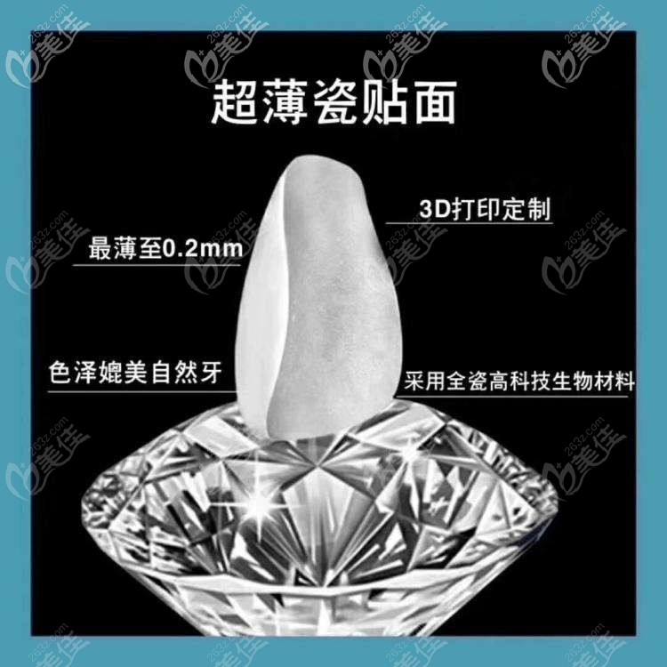 我做的贴面外观