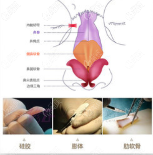 成都素美软糖鼻优势 成都素美软糖鼻优势