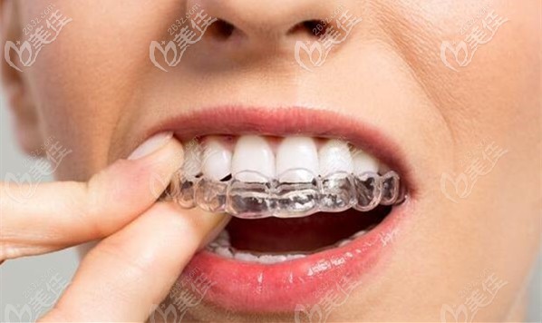 佛山拜尔口腔的牙齿正畸优惠价格介绍