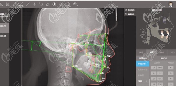 CT诊断口腔效果图