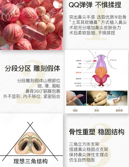 <!--<i data=20240703-sp></i>-->软糖鼻的优势 <!--<i data=20240703-sp></i>-->软糖鼻的优势