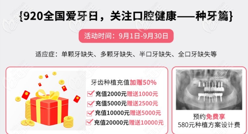 活动期间潍坊可恩口腔种植牙优惠价格
