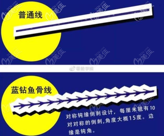 美国强生蓝钻鱼骨线型号 美国强生蓝钻鱼骨线型号