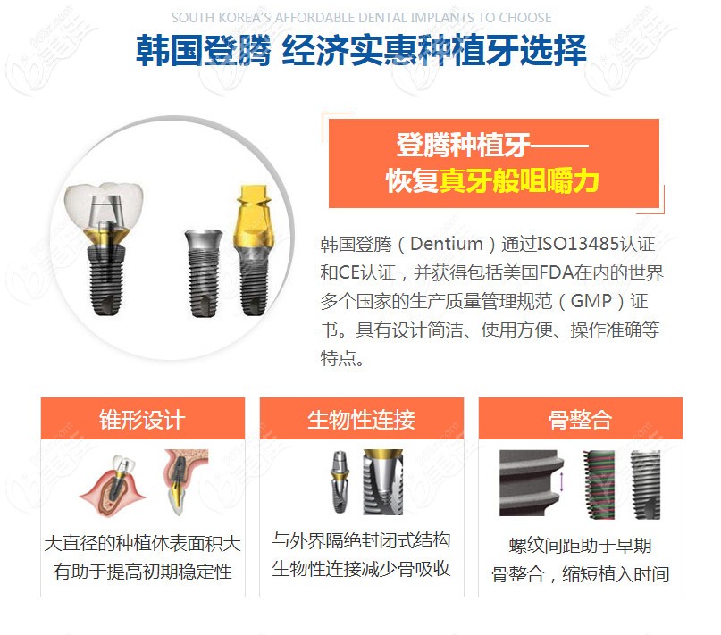 韩国登腾种植牙的优势