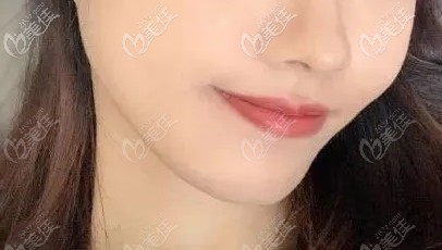 闭嘴也看不出来牙套的存在 闭嘴也看不出来牙套的存在