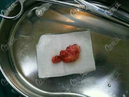 取出的生长因子