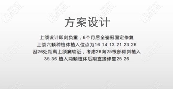 上半口ALL-ON-6即刻负重种植牙方案