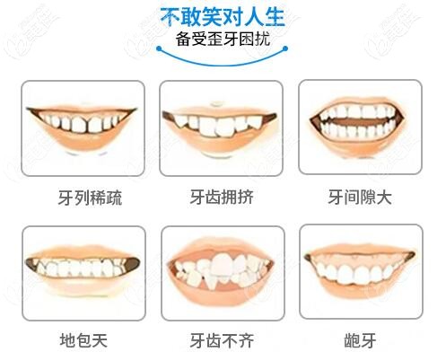 武汉虎泉口腔牙齿矫正适应症 武汉虎泉口腔牙齿矫正适应症