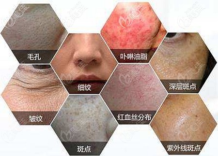 崔光静医生解析常见的皮肤问题