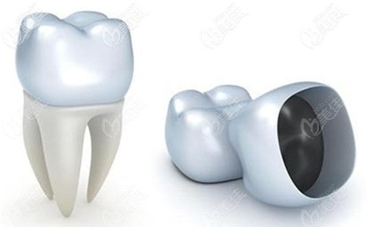 金永俊院长浅谈前牙美学种植的必要