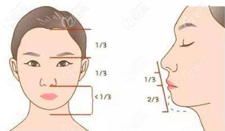 突嘴可能需要正颌手术改善