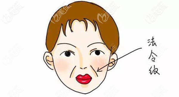 面部出现深重的法令纹
