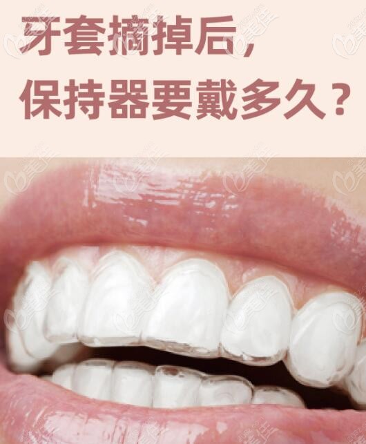 保持器究竟要戴多久? 保持器究竟要戴多久?