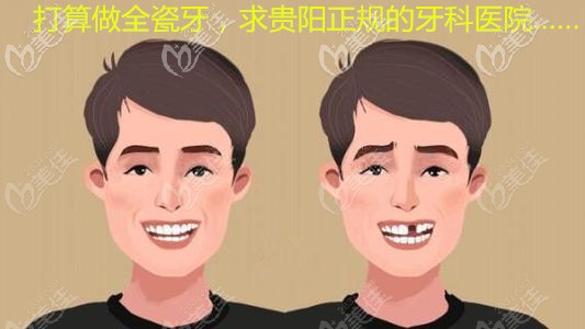 贵阳南明区丁泽鲤口腔做一颗爱尔创魅影全瓷牙要2200贵吗