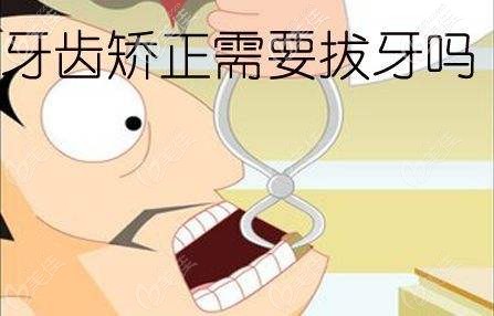 宋吉宁指出牙齿矫正并不一定就要拔牙 宋吉宁指出牙齿矫正并不一定就要拔牙