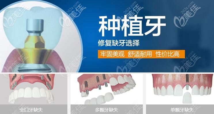 邛崃新桥口腔种植牙怎么样 邛崃新桥口腔种植牙怎么样