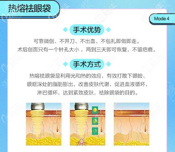 热效溶脂祛眼袋手术方法和优势介绍