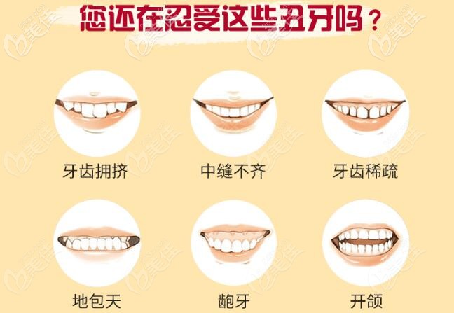 时代天使隐形矫正适应症 时代天使隐形矫正适应症