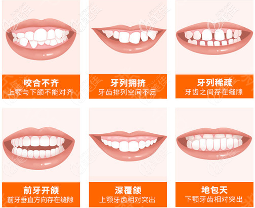 北京壹加壹牙科张建朋擅长牙齿矫正 北京壹加壹牙科张建朋擅长牙齿矫正