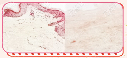 3D生物束带产生无细胞残留的组织支架