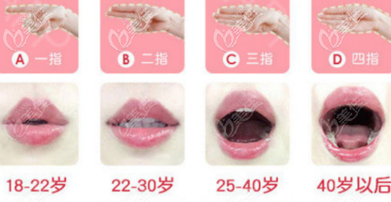 阴道衰老程度图