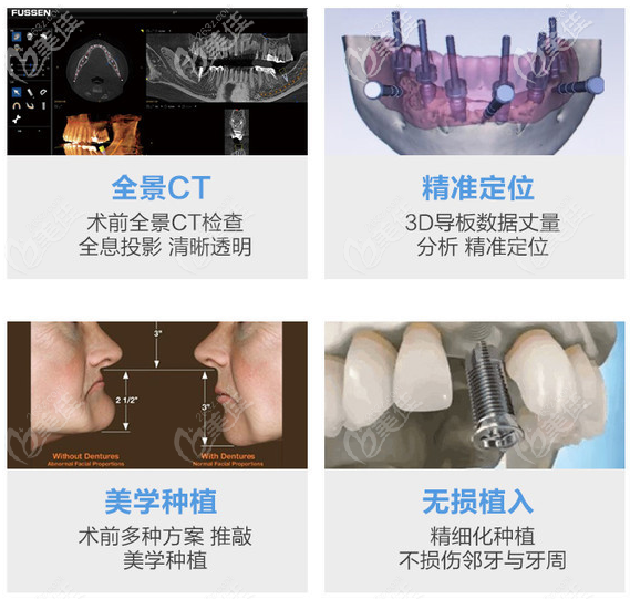 上海美冠口腔种植牙设备优势