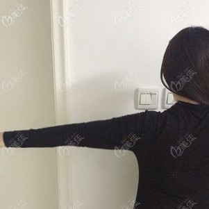 胳膊吸脂术后7天依旧肿胀 胳膊吸脂术后7天依旧肿胀