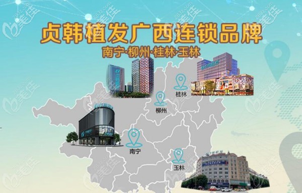 贞韩植发在广西拥有四大分院 贞韩植发在广西拥有四大分院