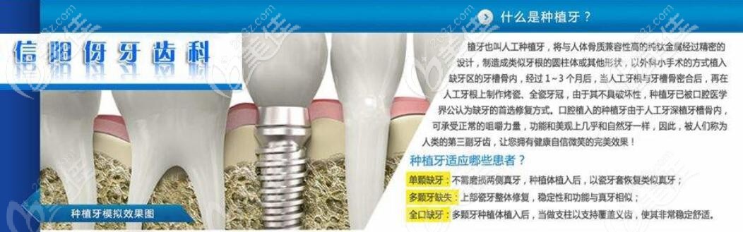 信阳伢牙齿科种植牙介绍