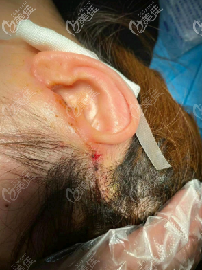 耳朵处的切口
